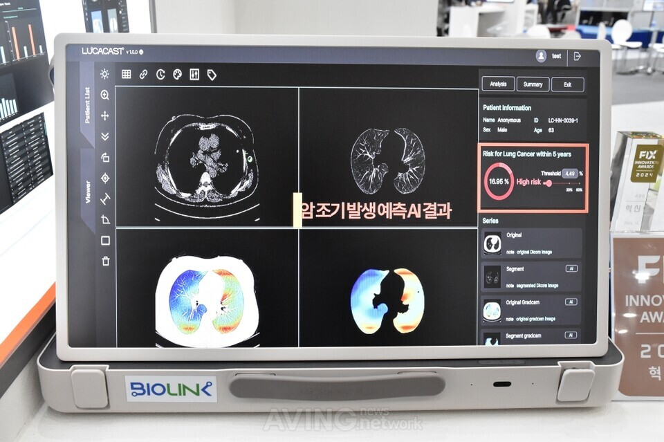 news-[AVING] 바이오링크, FIX 2024서 폐암 발생 예측 AI 소프트웨어 소개해... “조기진단 통한 빠른 치료계획 수립 가능하게 해!” image
