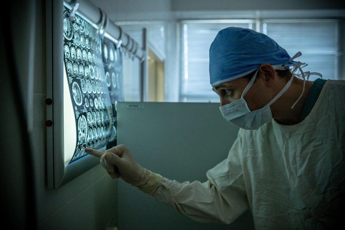 경도 진단 기준이 되는 뇌영상검사 자료