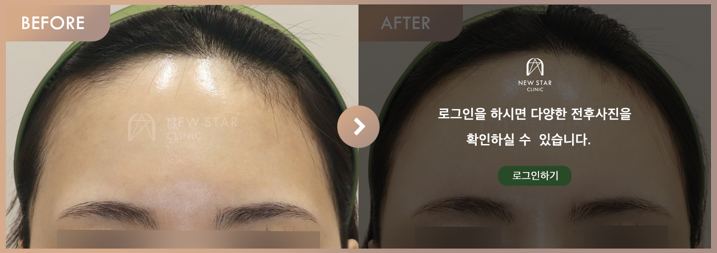 Before & After