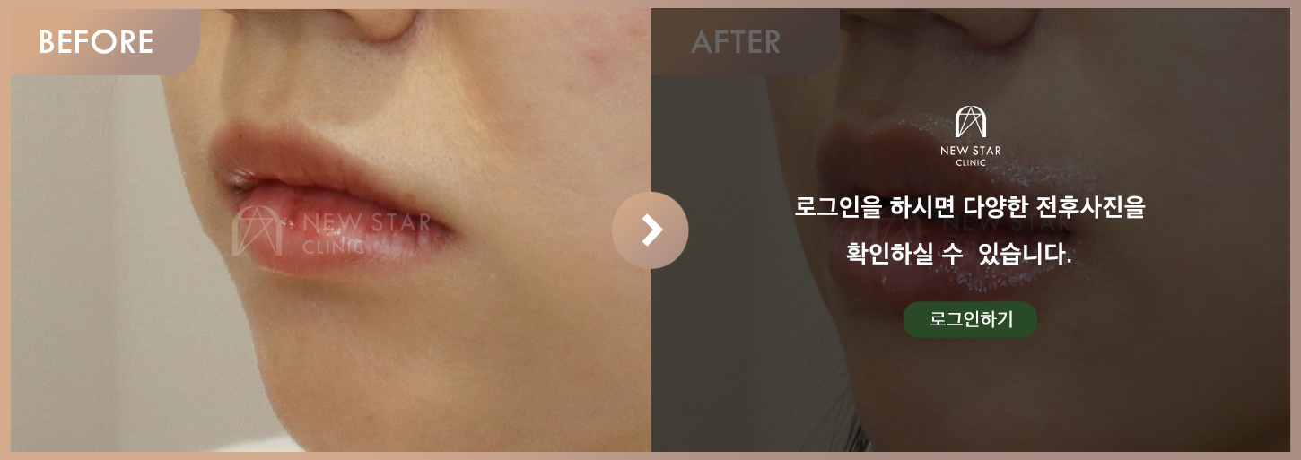 Before & After