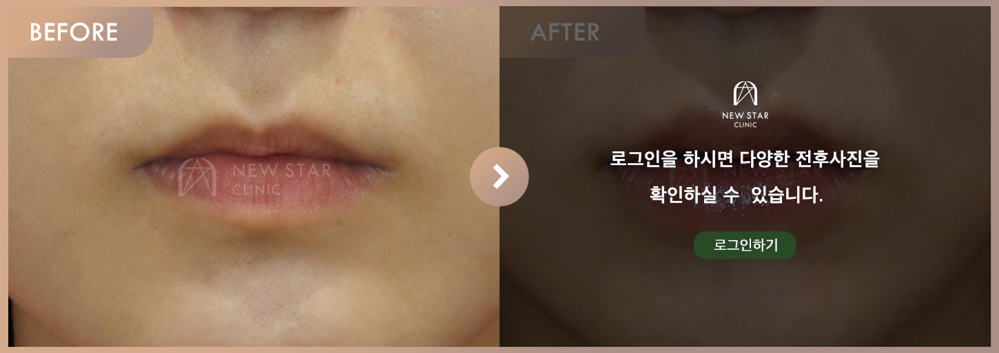 Before & After