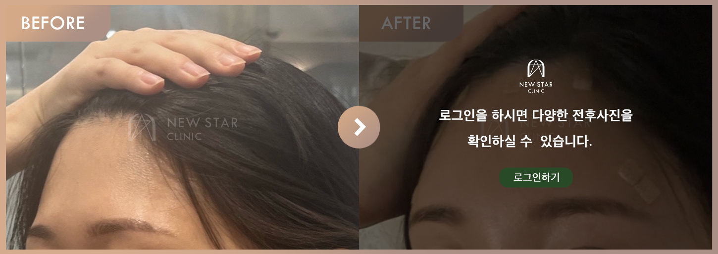 Before & After