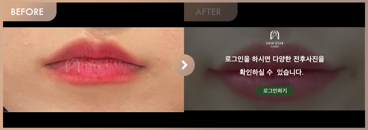 Before & After
