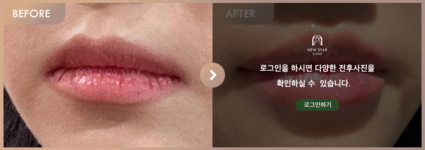 Before & After
