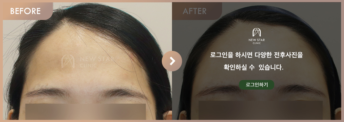 Before & After