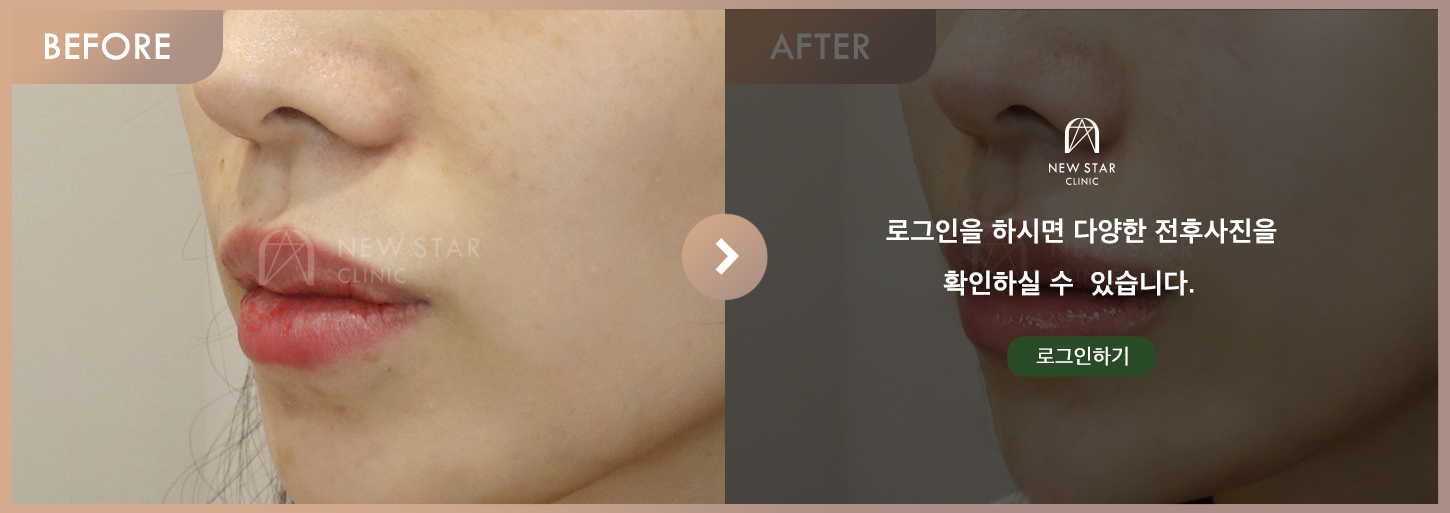 Before & After