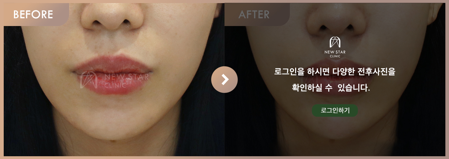 Before & After