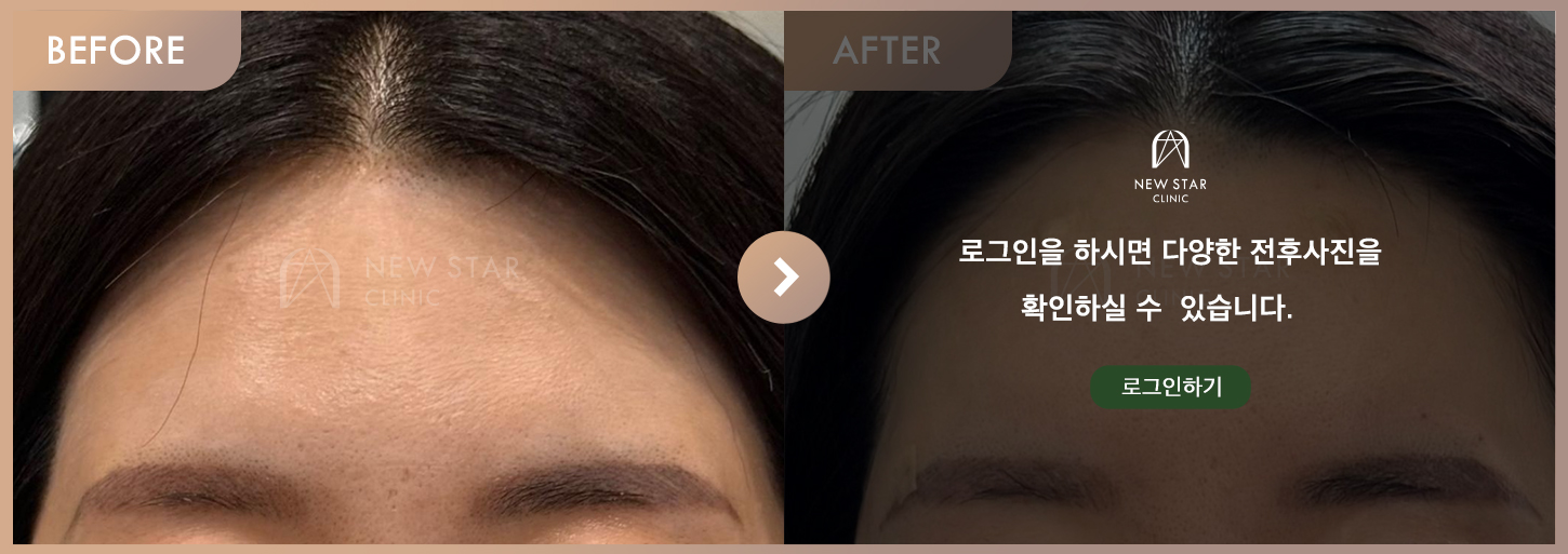 Before & After