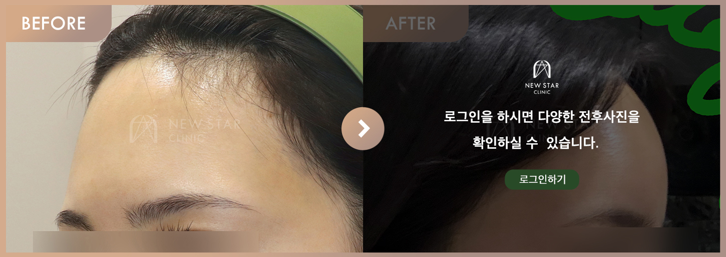 Before & After