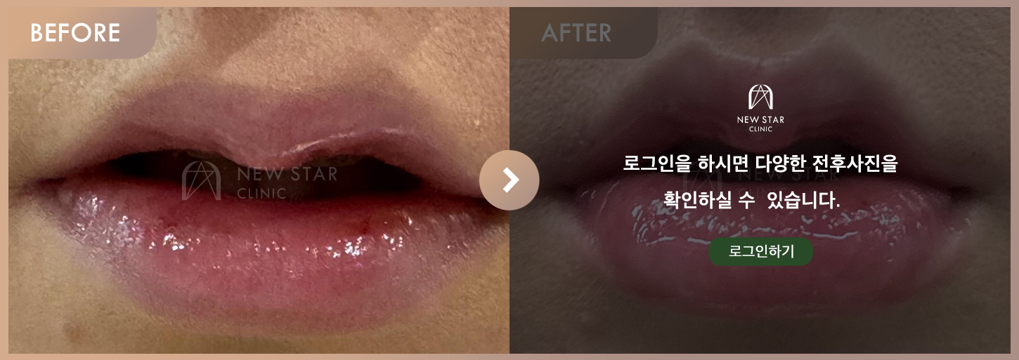 Before & After