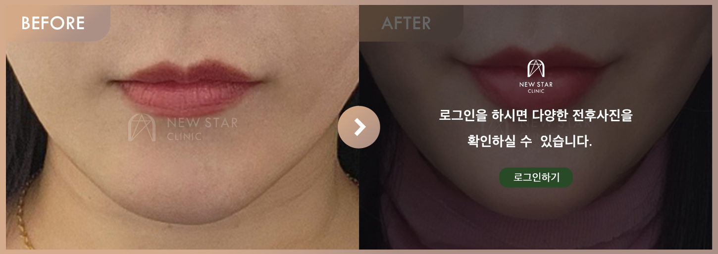Before & After