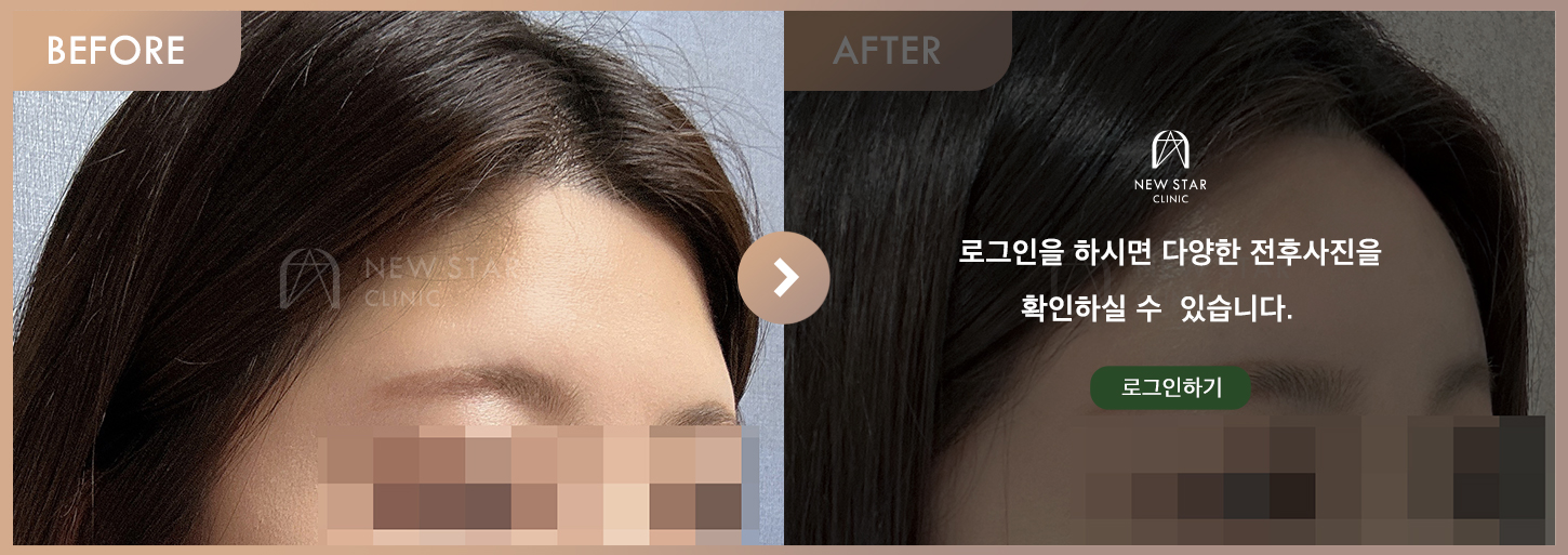 Before & After