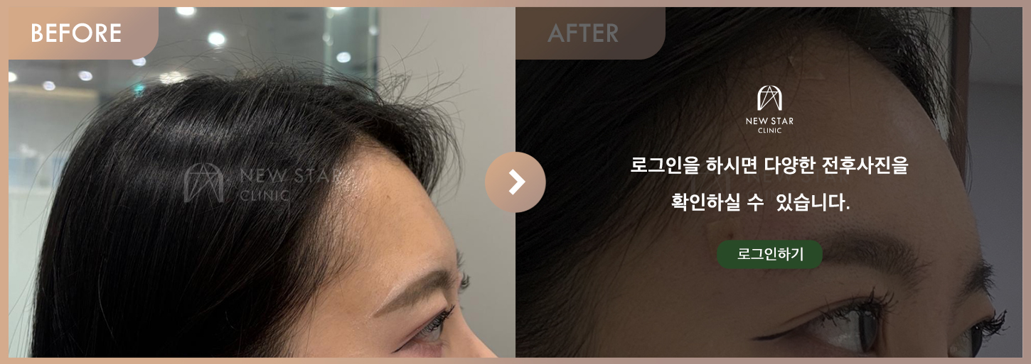 Before & After