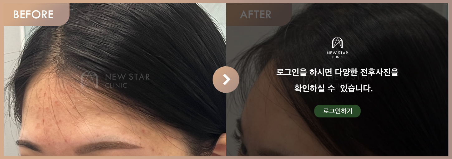 Before & After