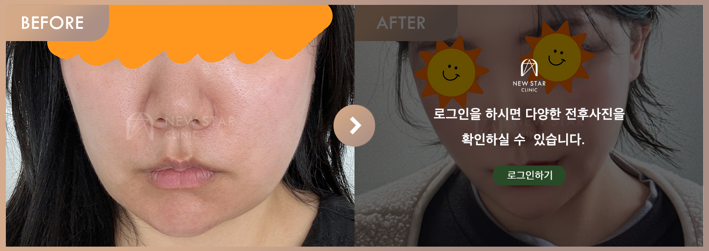 Before & After
