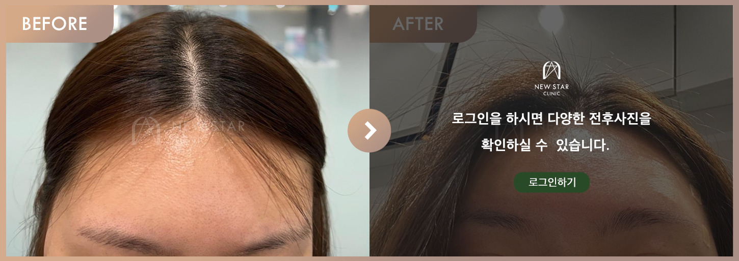 Before & After