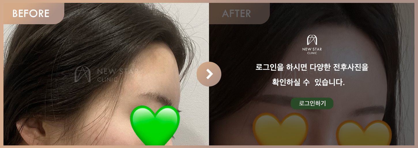 ビフォーアフター