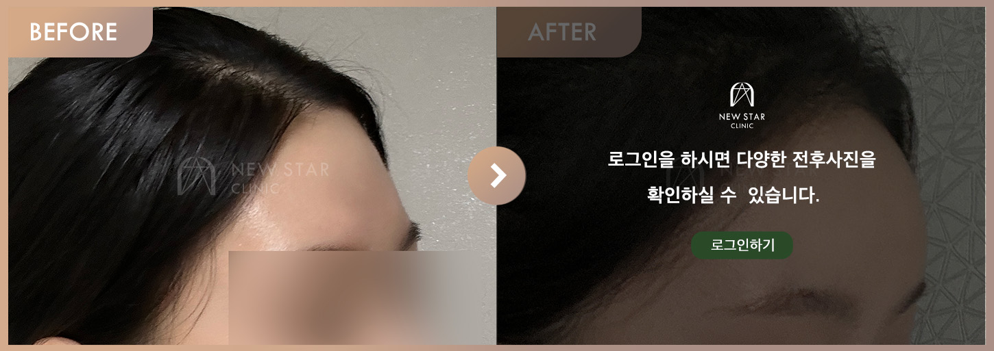 ビフォーアフター