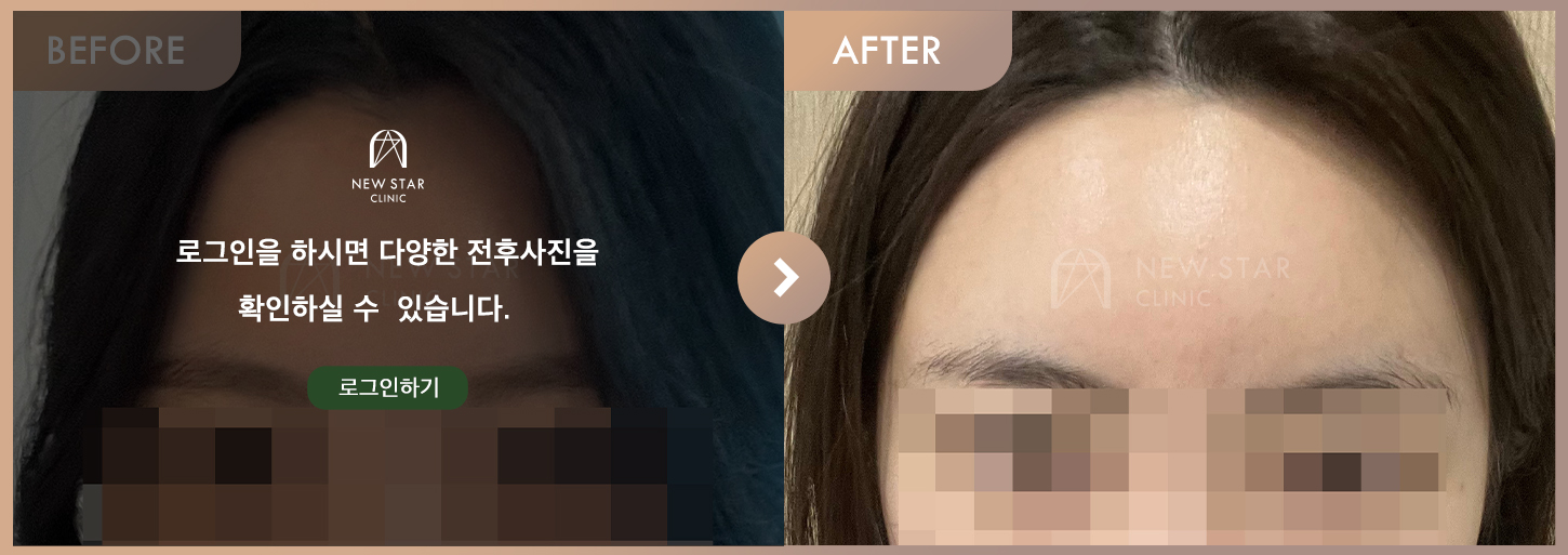 ビフォーアフター