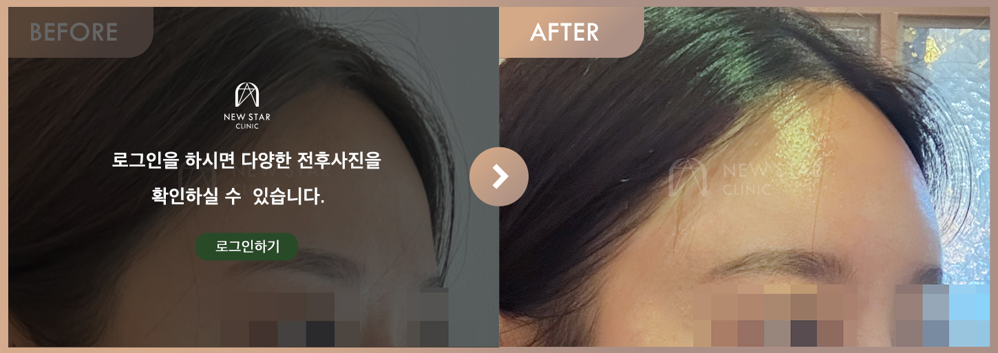 ビフォーアフター