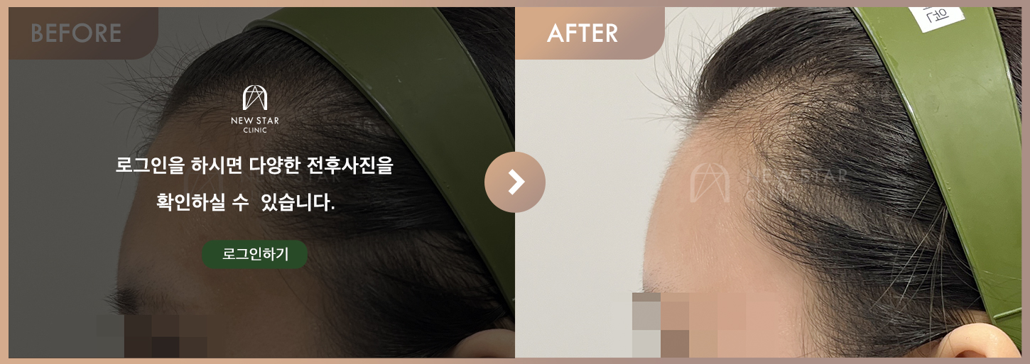 ビフォーアフター