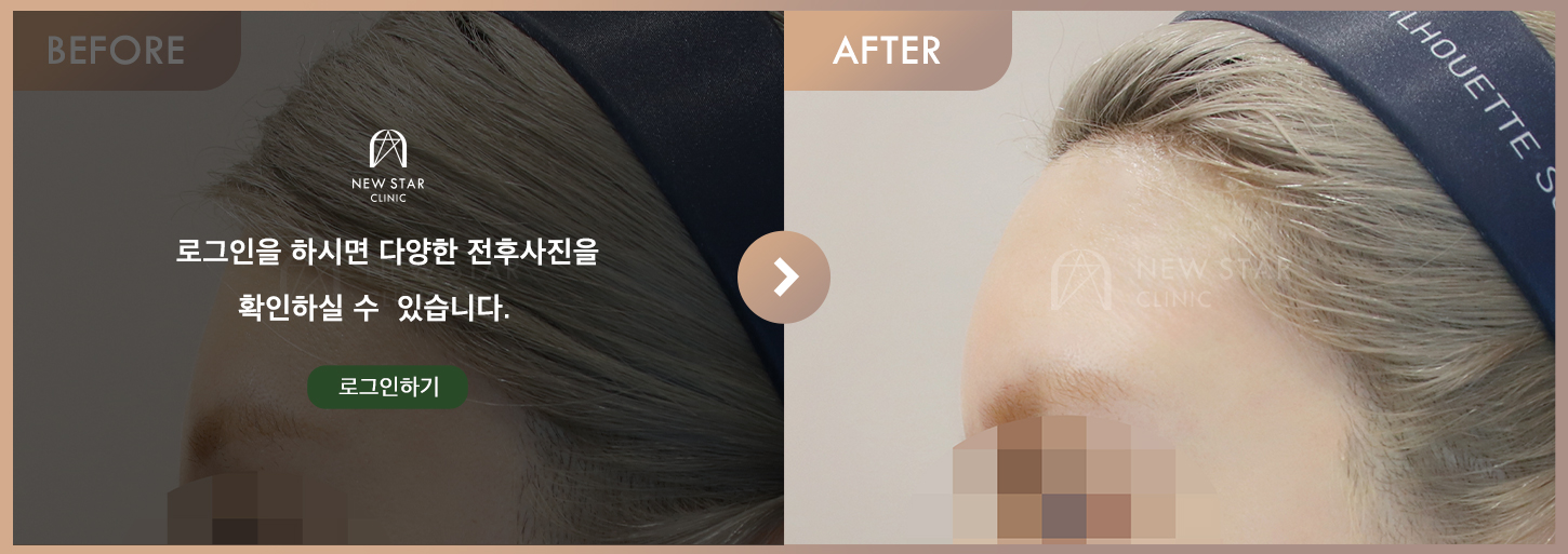 ビフォーアフター