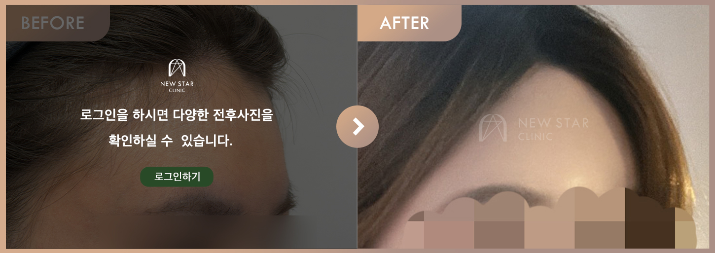 ビフォーアフター