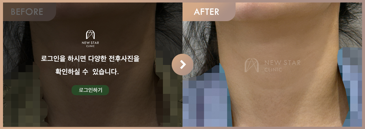 ビフォーアフター