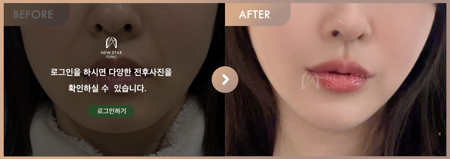 ビフォーアフター