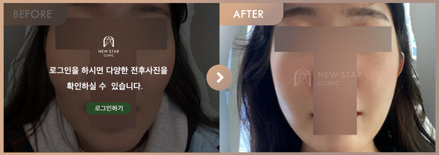 ビフォーアフター