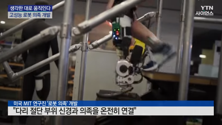 의족 착용한 사람